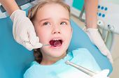 stock photo of health  - girl opened her mouth to check with a dentist - JPG 