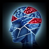picture of neurology  - Mental disability with brain injury and neurological disorder represented by a human head and mind broken in pieces to symbolize a severe medical mental trauma and cognitive illness on white background - JPG 