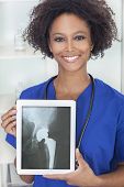 pic of future  - An African American female woman medical doctor in hospital holding a tablet computer with a hip replacement patient X - JPG 